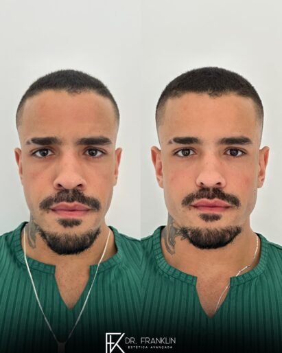 565102385_18024882176749779_4057699665295907085_n