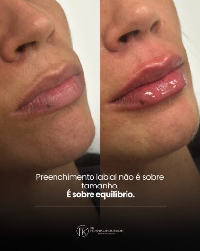 627653881_18037174082749779_4046757581582987785_n